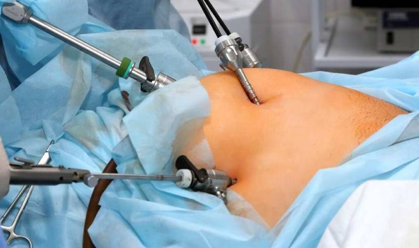 gynecology-laparoscopic-surgery-in-basaveshwar-nagar-bengaluru