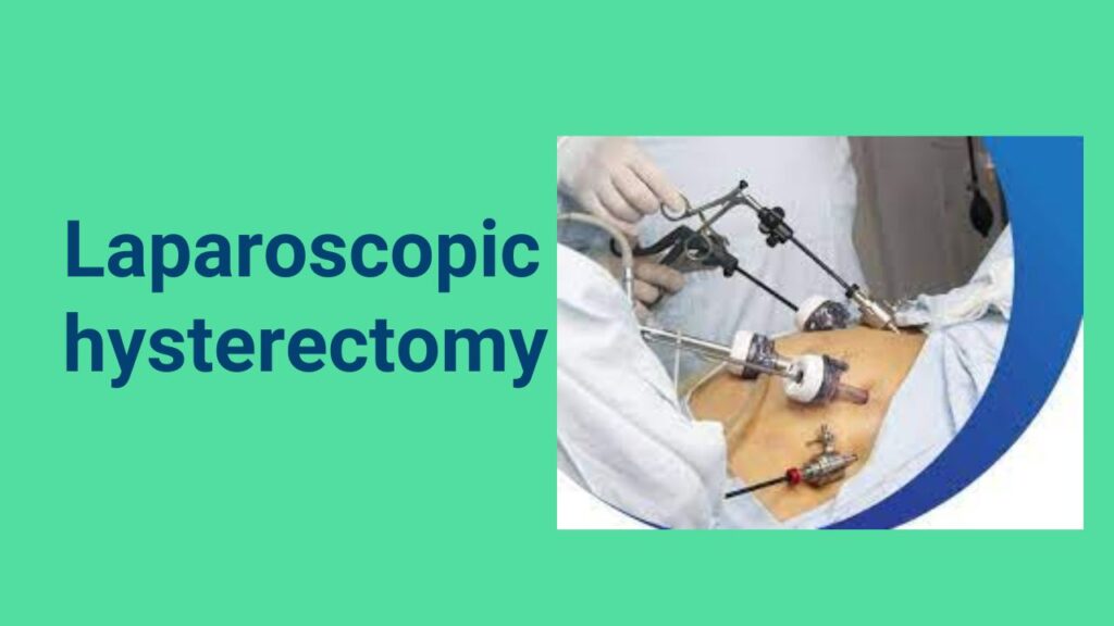 Laparoscopy Surgery in Bangalore